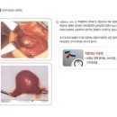 길흉부외과 네이버블로그