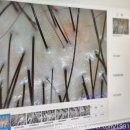 나산센터-1 | 서현 두피관리 웰킨 서현점 후기 : 어제 염색하고 바로 스케일링 받기