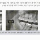 더섬세한치과의원 네이버블로그