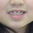 서울하상운치과교정과치과의원 이미지