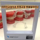 엔젤치과의원 | 치과 턱관절치과 야간진료 투명교정 엔젤얼라이너 교정전문치과 동대문구 중랑구 성동구 광진구...