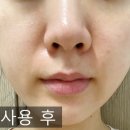 보람메디칼 이미지