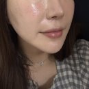 이프라임유통지점 | 강남 울쎄라피 프라임 300샷 솔직후기 / 효과 통증 가격 내돈내산