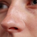 스펀지성형외과의원 | 코막힘 오래됐다면 비중격 만곡증 수술후기 통증 회복