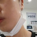 제일어린이집 | 부산 전포동 예쁘리 서면피부관리 받고 코 블랙헤드 정리 제대로 하고 온 후기