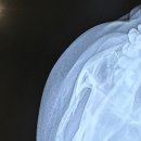 더강추정형외과의원 이미지