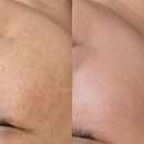 러버블리 이미지