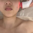 CU 중흥S클래스 남문점 | 광교 피부관리 에스테틱 티아 여드름피부 결광관리 후기