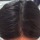강남 여자 가르마 탈모 헤어라인 채우기 소레아 내돈내산 후기