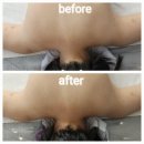 미(美)스킨앤바디 - 의정부시 | 송촌동피부관리 다경미힐링스킨앤바디 인비덤 등관리 후기