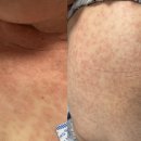 라이프반점 이미지