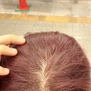 에스경매 | 출산 후 정수리 초기 탈모 걱정 끝! 내돈내산 비오티아에스 리볼좀 후기
