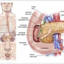 급성 췌장염의 원인,증상,진단 및 치료 이미지