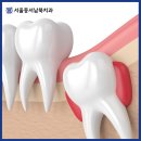 불로치과의원 이미지