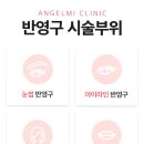 엔젤미의원 네이버블로그