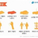 신장 이상 및 결석 증상부터 신장암까지 : 태초수 소개 이미지