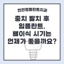 컬럼비아치과의원 | 충치 발치 후 임플란트 뼈이식 시기는?