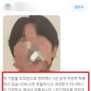암환자가발, 설마 인터넷으로 주문하는거 아니시죠..?