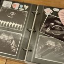 임신 28주 - 30주차의 기록: 셀프만삭사진 튼살 백일해접종