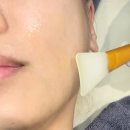 당신만의가치벨유의원 | 명동역피부과 온다 리프팅 후기