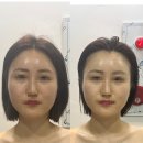 옷미인 | 청주윤곽관리 후광미인｜프리미엄 뱀부 윤곽관리 받고 온 후기