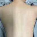 컬러나인한의원 | [판교한의원] 분당 등필링 내돈내산 후기 2탄 (Feat.컬러나인한의원)