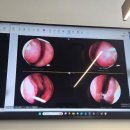 강남대로101길 28 (1) | 서울 비염 성지 라경찬 한의원 후기｜비염 5단계 진단 후 관리 시작과 치료 방향 기록