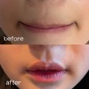 용산-303 | 용산 새봄 왁싱샵 | 용산 왁싱 잘하는 새봄 왁싱샵 추천드려요 ✨🙌🏻