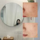 정선생 | 홍대 정선생 에스테틱 후기 (내돈내산)