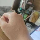 순천종로약국 | 순천 웨이팅 피부과 방문기