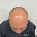 에테르노 | 전주 익산 군산 두피염색 가격 후기 추천 에테르노전주점