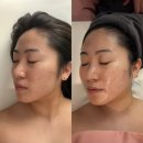 골드라인에스테틱 | 부산 에스테틱 추천 효과 좋은 골드 페이스라인 윤곽관리 후기 :: 끌리메 센텀점