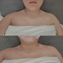 블링블링스킨케어 | 인천피부관리샵 서해구 블링블링스킨케어 서구청역피부샵에서 화난피부진정