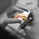 네이치과기공소 이미지