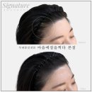 마음에점을찍다두피SMP 이미지
