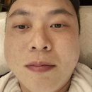 솔고헬스케어 명륜점 | 부산 명륜동얼굴관리 올가드림뷰티 명륜점 모공디톡스 체험 후기