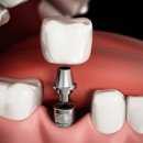 청플란트치과의원 이미지