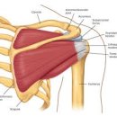 충돌 증후군(impingement syndrome)에 대한 오해 이미지