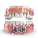 열린오치과의원 이미지