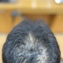 MZ세대 탈모관리 탈모커버고민 부산사상르네시떼미용실 / (북구사상구진구동래구강서구대저동김해시해운대구남구영도구동구서구중구금정구사하구 이미지