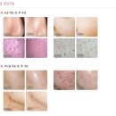 피브엔의원 이미지