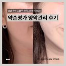 구로-구로-구로-26 | 약손명가 구로디지털점 양악관리 받고 온 얼굴 라인 관리 후기 구로에스테틱 추천