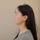 약손명가 에스테틱(구리갈매점) | 구리 피부관리, 약손명가 구리갈매점 10회 내돈내산 후기