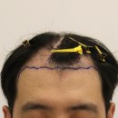 부산 맘모스헤어라인의원 이미지