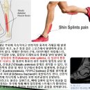 [11강-발목/발-26](105강) 후경골근, 장지굴근, 장무지굴근, shin splints 등 이미지