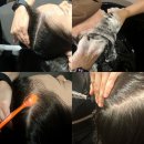 WT메소드 수유점 | 수유역두피클리닉, WT메소드 수유점 지루성두피 스폐셜관리 받고 온 후기!