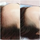 김헤어라인 이미지