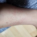 JNC메디칼 | 보습과 진정의 끝판 98겔