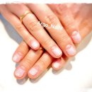 아르고네일 이미지