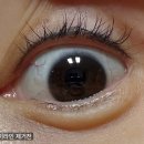 제이유피부과의원 | 1차 점막아이라인문신제거 시술/ 점막아이라인 제거 한달차/서울 도곡역 제이유피부과/내돈내산/피코레이저